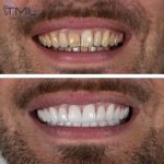 Antalya Dental Clinic Teledentistry