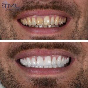 Antalya Dental Clinic Teledentistry