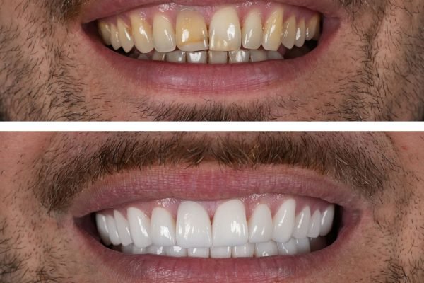 Antalya Dental Clinic Teledentistry