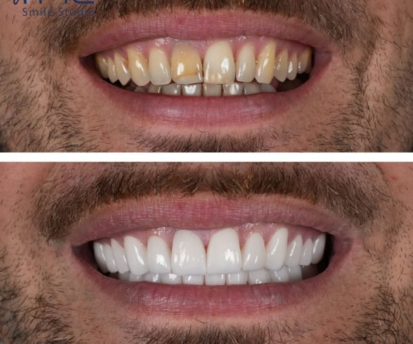 Antalya Dental Clinic Teledentistry