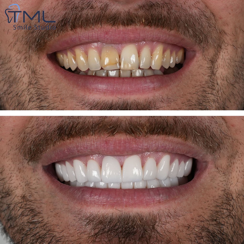 Antalya Dental Clinic Teledentistry